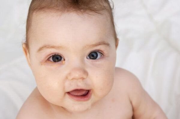 Conjuntivitis En Bebés Síntomas Causas Y Tratamiento 