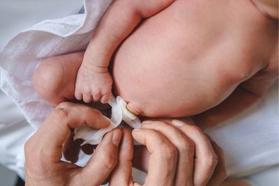 Bebé recién nacido con una pequeña hernia umbilical