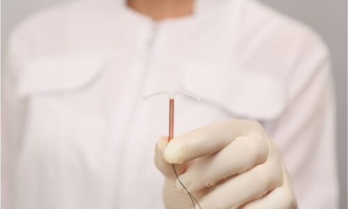 Médico sosteniendo un DIU en la mano